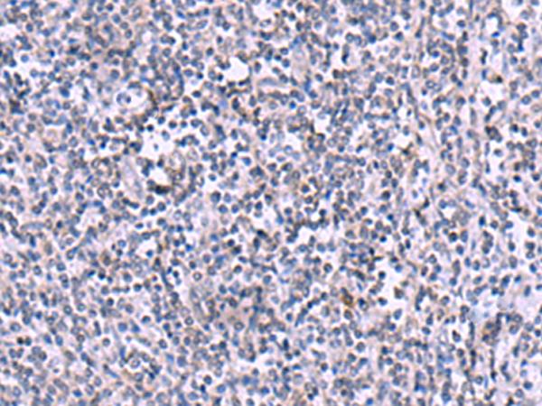 KIR3DL1 Antibody - Immunohistochemistry of paraffin-embedded Human tonsil tissue  using KIR3DL1 Polyclonal Antibody at dilution of 1:105(×200)
