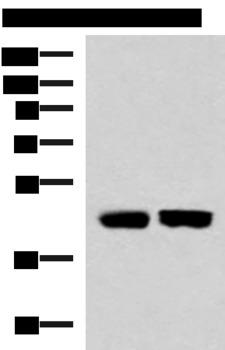 KIR3DL1 Antibody - Western blot analysis of Human fetal liver tissue and Human liver tissue lysates  using KIR3DL1 Polyclonal Antibody at dilution of 1:1000