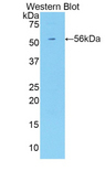 KIR3DL2 Antibody - Western blot of recombinant CD158k / KIR3DL2.  This image was taken for the unconjugated form of this product. Other forms have not been tested.