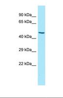 KIR3DL2 Antibody - Western blot of Human Hela. KIR3DL2 antibody dilution 1.0 ug/ml.  This image was taken for the unconjugated form of this product. Other forms have not been tested.