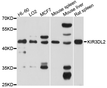 KIR3DL2 Antibody - Western blot analysis of extracts of various cell lines, using KIR3DL2 antibody at 1:1000 dilution. The secondary antibody used was an HRP Goat Anti-Rabbit IgG (H+L) at 1:10000 dilution. Lysates were loaded 25ug per lane and 3% nonfat dry milk in TBST was used for blocking. An ECL Kit was used for detection and the exposure time was 60s.