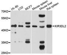 KIR3DL2 Antibody - Western blot analysis of extracts of various cell lines, using KIR3DL2 antibody at 1:1000 dilution. The secondary antibody used was an HRP Goat Anti-Rabbit IgG (H+L) at 1:10000 dilution. Lysates were loaded 25ug per lane and 3% nonfat dry milk in TBST was used for blocking. An ECL Kit was used for detection and the exposure time was 60s.