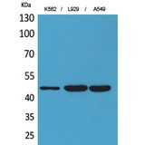 KIR3DL3 / CD158z Antibody - Western blot of CD158z antibody
