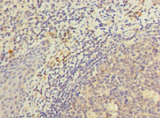 KIR3DL3 / CD158z Antibody - Immunohistochemistry of paraffin-embedded human tonsil tissue at dilution 1:100