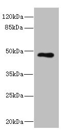 KIR3DL3 / CD158z Antibody - Western blot All Lanes: KIR3DL3 antibody IgG at 1.75ug/ml+ Jurkat whole cell lysate Secondary Goat polyclonal to rabbit IgG at 1/10000 dilution Predicted band size: 45 kDa Observed band size: 45 kDa