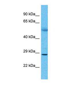 KIR3DS1 / NKB1 Antibody - Western blot of Human Lung Tumor. KIR3DS1 antibody dilution 1.0 ug/ml.  This image was taken for the unconjugated form of this product. Other forms have not been tested.