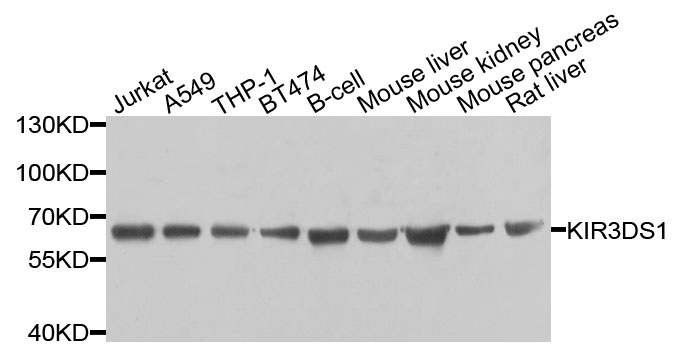 KIR3DS1 / NKB1 Antibody - Western blot analysis of extracts of various cells.