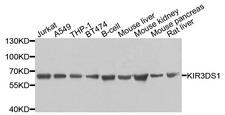 KIR3DS1 / NKB1 Antibody - Western blot analysis of extracts of various cells.