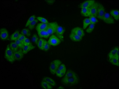 KIR3DS1 / NKB1 Antibody - Immunofluorescence staining of HepG2 cells diluted at 1:100, counter-stained with DAPI. The cells were fixed in 4% formaldehyde, permeabilized using 0.2% Triton X-100 and blocked in 10% normal Goat Serum. The cells were then incubated with the antibody overnight at 4°C.The Secondary antibody was Alexa Fluor 488-congugated AffiniPure Goat Anti-Rabbit IgG (H+L).