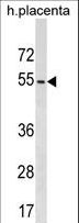 KIRREL2 / FILTRIN Antibody - KIRREL2 Antibody western blot of human placenta tissue lysates (35 ug/lane). The KIRREL2 antibody detected the KIRREL2 protein (arrow).