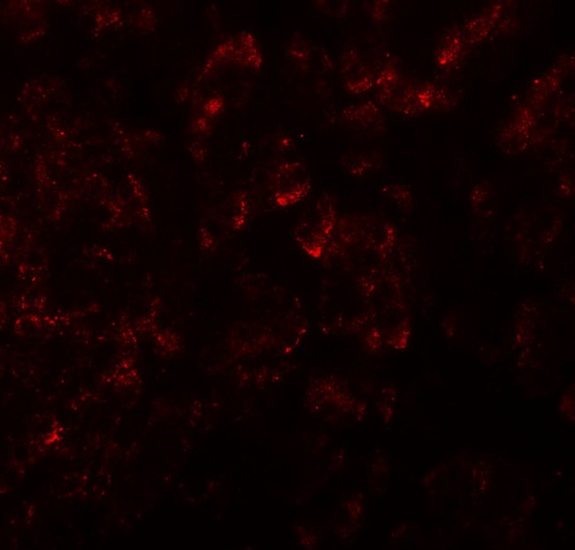 KIRREL2 / FILTRIN Antibody - Immunofluorescence of KIRREL2 in human pancreas tissue with KIRREL2 antibody at 20 ug/ml.