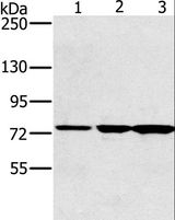 KIRREL2 / FILTRIN Antibody - Western blot analysis of Human testis tissue, Jurkat cell and mouse liver tissue, using KIRREL2 Polyclonal Antibody at dilution of 1:500.