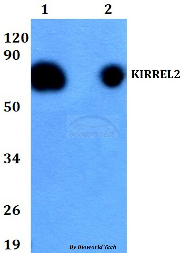 KIRREL2 / FILTRIN Antibody - Western blot of KIRREL2 antibody at 1:500 dilution. Lane 1: HEK293T whole cell lysate. Lane 2: H9C2 whole cell lysate.