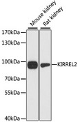 KIRREL2 / FILTRIN Antibody - Western blot analysis of extracts of various cell lines, using KIRREL2 antibody at 1:3000 dilution. The secondary antibody used was an HRP Goat Anti-Rabbit IgG (H+L) at 1:10000 dilution. Lysates were loaded 25ug per lane and 3% nonfat dry milk in TBST was used for blocking. An ECL Kit was used for detection and the exposure time was 90s.