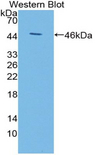 KISS1 / Kisspeptin / Metastin Antibody - Western blot of KISS1 / Kisspeptin / Metastin antibody using a recombinant protein encoding aa 1-126 with a His and GST tag.