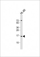 KISS1 / Kisspeptin / Metastin Antibody - Anti-KISS1 Antibody at 1:2000 dilution + HL-60 whole cell lysates Lysates/proteins at 20 ug per lane. Secondary Goat Anti-Rabbit IgG, (H+L), Peroxidase conjugated at 1/10000 dilution Predicted band size : 15 kDa Blocking/Dilution buffer: 5% NFDM/TBST.