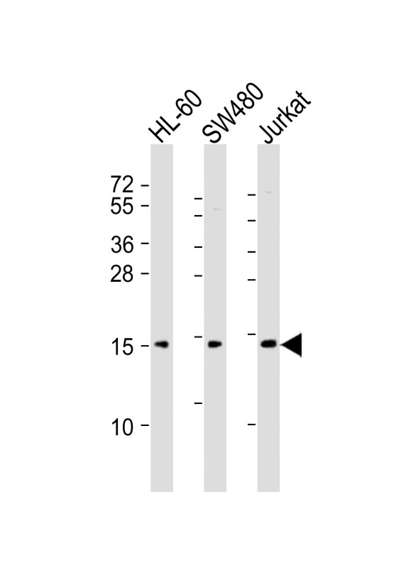 KISS1 / Kisspeptin / Metastin Antibody - All lanes : Anti-KISS1 Antibody at 1:2000 dilution Lane 1: HL-60 whole cell lysates Lane 2: SW480 whole cell lysates Lane 3: Jurkat whole cell lysates Lysates/proteins at 20 ug per lane. Secondary Goat Anti-Rabbit IgG, (H+L), Peroxidase conjugated at 1/10000 dilution Predicted band size : 15 kDa Blocking/Dilution buffer: 5% NFDM/TBST.
