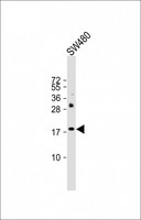 KISS1 / Kisspeptin / Metastin Antibody - Anti-KISS1 Antibody at 1:500 dilution + SW480 whole cell lysates Lysates/proteins at 20 ug per lane. Secondary Goat Anti-Rabbit IgG, (H+L), Peroxidase conjugated at 1/10000 dilution Predicted band size : 15 kDa Blocking/Dilution buffer: 5% NFDM/TBST.