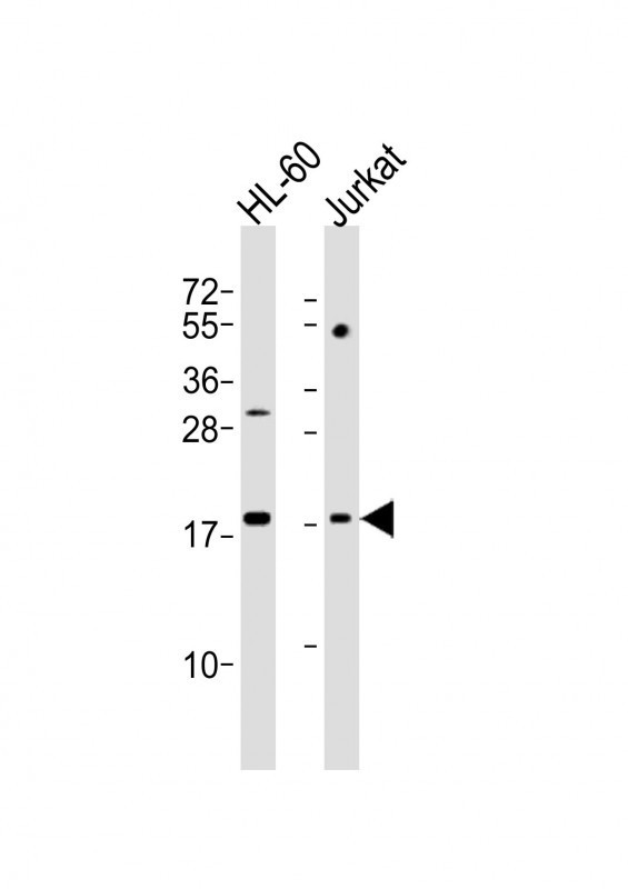 KISS1 / Kisspeptin / Metastin Antibody - All lanes : Anti-KISS1 Antibody at 1:2000 dilution Lane 1: HL-60 whole cell lysates Lane 2: Jurkat whole cell lysates Lysates/proteins at 20 ug per lane. Secondary Goat Anti-Rabbit IgG, (H+L), Peroxidase conjugated at 1/10000 dilution Predicted band size : 15 kDa Blocking/Dilution buffer: 5% NFDM/TBST.