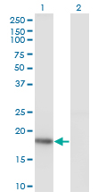 KISS1 / Kisspeptin / Metastin Antibody - Western blot of KISS1 expression in transfected 293T cell line by KISS1 monoclonal antibody (M05), clone 1F7.