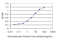 KISS1 / Kisspeptin / Metastin Antibody - Detection limit for recombinant GST tagged KISS1 is approximately 0.3 ng/ml as a capture antibody.