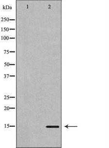 KISS1 / Kisspeptin / Metastin Antibody - Western blot analysis of extracts of mouse brain tissue lysate using KISS1 antibody. The lane on the left is treated with the antigen-specific peptide.