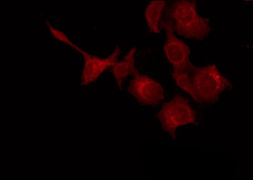 KISS1 / Kisspeptin / Metastin Antibody - Staining HepG2 cells by IF/ICC. The samples were fixed with PFA and permeabilized in 0.1% Triton X-100, then blocked in 10% serum for 45 min at 25°C. The primary antibody was diluted at 1:200 and incubated with the sample for 1 hour at 37°C. An Alexa Fluor 594 conjugated goat anti-rabbit IgG (H+L) Ab, diluted at 1/600, was used as the secondary antibody.