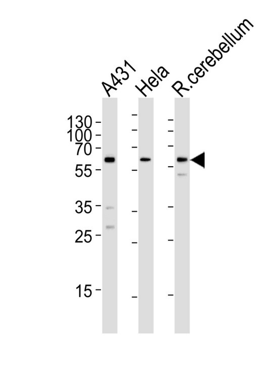 KISS1R / GPR54 Antibody - Western blot of lysates from A431, HeLa cell line and rat cerebellum tissue lysate (from left to right), using KISS1R Antibody. Antibody was diluted at 1:1000 at each lane. A goat anti-rabbit IgG H&L (HRP) at 1:5000 dilution was used as the secondary antibody. Lysates at 35ug per lane.