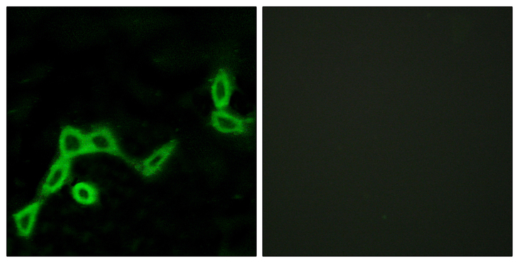 KISS1R / GPR54 Antibody - Immunofluorescence analysis of LOVO cells, using KISS1R Antibody. The picture on the right is blocked with the synthesized peptide.