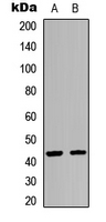 KISS1R / GPR54 Antibody - Western blot analysis of GPR54 expression in HEK293T (A); A549 (B) whole cell lysates.