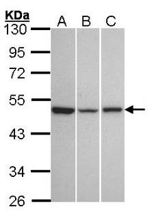 KISS1R / GPR54 Antibody - Sample (30 ug of whole cell lysate). A: A431. B: Hela. C: Hep G2. 10% SDS PAGE. KISS1R antibody diluted at 1:1000. 