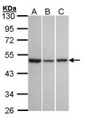 KISS1R / GPR54 Antibody - Sample (30 ug of whole cell lysate). A: A431. B: Hela. C: Hep G2. 10% SDS PAGE. KISS1R antibody diluted at 1:1000. 