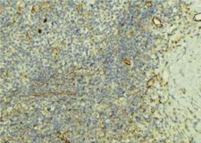 KISS1R / GPR54 Antibody - 1:100 staining human lymph tissue by IHC-P. The sample was formaldehyde fixed and a heat mediated antigen retrieval step in citrate buffer was performed. The sample was then blocked and incubated with the antibody for 1.5 hours at 22°C. An HRP conjugated goat anti-rabbit antibody was used as the secondary.
