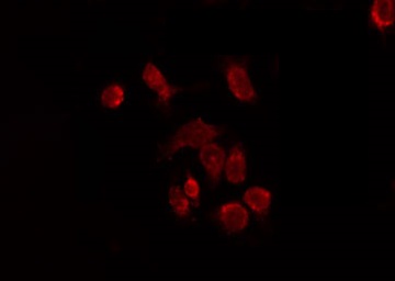 KISS1R / GPR54 Antibody - Staining HeLa cells by IF/ICC. The samples were fixed with PFA and permeabilized in 0.1% Triton X-100, then blocked in 10% serum for 45 min at 25°C. The primary antibody was diluted at 1:200 and incubated with the sample for 1 hour at 37°C. An Alexa Fluor 594 conjugated goat anti-rabbit IgG (H+L) Ab, diluted at 1/600, was used as the secondary antibody.