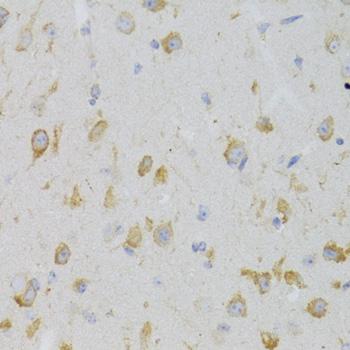 KISS1R / GPR54 Antibody - Immunohistochemistry of paraffin-embedded Mouse brain using KISS1R Polyclonal Antibody at dilution of 1:100 (40x lens).