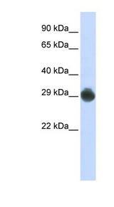 KITLG / SCF Antibody - KITLG / SCF antibody Western blot of HepG2 cell lysate. This image was taken for the unconjugated form of this product. Other forms have not been tested.