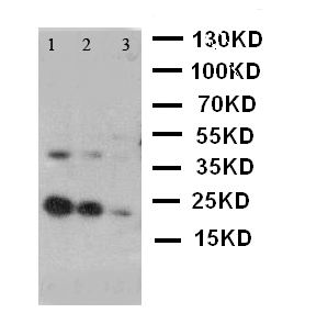 KITLG / SCF Antibody - WB of KITLG / SCF antibody. Lane 1: Recombinant Human SCF Protein 10ng. Lane 2: Recombinant Human SCF Protein 5ng. Lane 3: Recombinant Human SCF Protein 2.5ng.