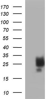 KITLG / SCF Antibody - HEK293T cells were transfected with the pCMV6-ENTRY control (Left lane) or pCMV6-ENTRY KITLG (Right lane) cDNA for 48 hrs and lysed. Equivalent amounts of cell lysates (5 ug per lane) were separated by SDS-PAGE and immunoblotted with anti-KITLG.