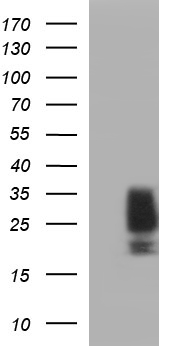 KITLG / SCF Antibody - HEK293T cells were transfected with the pCMV6-ENTRY control (Left lane) or pCMV6-ENTRY KITLG (Right lane) cDNA for 48 hrs and lysed. Equivalent amounts of cell lysates (5 ug per lane) were separated by SDS-PAGE and immunoblotted with anti-KITLG.
