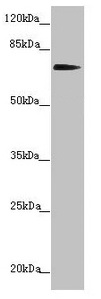 KIZ / PLK1S1 Antibody - Western blot All lanes: KIZ antibody at 2.41µg/ml + Hela whole cell lysate Secondary Goat polyclonal to rabbit IgG at 1/10000 dilution Predicted band size: 76, 63, 70, 74, 60 kDa Observed band size: 76 kDa