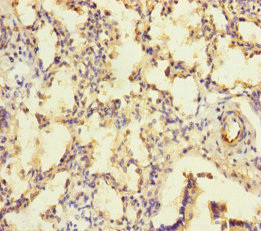 KIZ / PLK1S1 Antibody - Immunohistochemistry of paraffin-embedded human lung tissue at dilution of 1:100