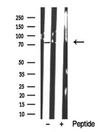 KIZ / PLK1S1 Antibody - Western blot analysis of Kizuna in lysates of HCT116 using Kizuna antibody.