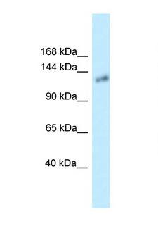 KL / Klotho Antibody - KL / Klotho antibody Western blot of Small Intestine lysate. Antibody concentration 1 ug/ml.  This image was taken for the unconjugated form of this product. Other forms have not been tested.