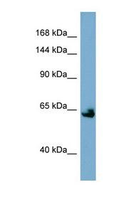 KL / Klotho Antibody - KL / Klotho antibody Western blot of NCI-H226 cell lysate. This image was taken for the unconjugated form of this product. Other forms have not been tested.