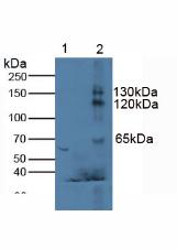 KL / Klotho Antibody - Western Blot; Sample. Lane1: Mouse Serum; Lane2: Mouse Testis Tissue.