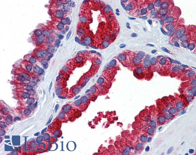 KL / Klotho Antibody - Anti-Klotho antibody IHC of human prostate. Immunohistochemistry of formalin-fixed, paraffin-embedded tissue after heat-induced antigen retrieval. Antibody concentration 5 ug/ml.  This image was taken for the unconjugated form of this product. Other forms have not been tested.