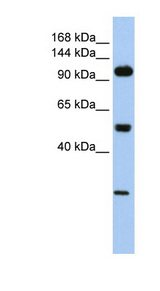 KL / Klotho Antibody - KL / Klotho antibody LS-B5728 Western Blot analysis of 721_B cell lysate.  This image was taken for the unconjugated form of this product. Other forms have not been tested.