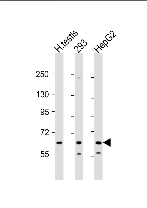 KL / Klotho Antibody - All lanes: Anti-Klotho Antibody (C-term) at 1:2000 dilution Lane 1: human testis lysate Lane 2: 293 whole cell lysate Lane 3: HepG2 whole cell lysate Lysates/proteins at 20 µg per lane. Secondary Goat Anti-Rabbit IgG, (H+L), Peroxidase conjugated at 1/10000 dilution. Predicted band size: 116 kDa Blocking/Dilution buffer: 5% NFDM/TBST.