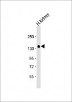 KL / Klotho Antibody - Anti-KL Antibody (Center) at 1:2000 dilution + Human kidney lysate Lysates/proteins at 20 µg per lane. Secondary Goat Anti-Rabbit IgG, (H+L), Peroxidase conjugated at 1/10000 dilution. Predicted band size: 116 kDa Blocking/Dilution buffer: 5% NFDM/TBST.