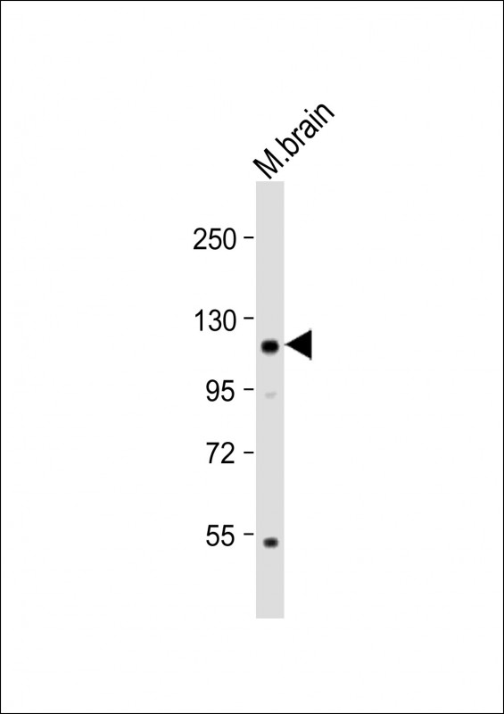 KL / Klotho Antibody - Anti-KL Antibody at 1:2000 dilution + Mouse brain lysate Lysates/proteins at 20 µg per lane. Secondary Goat Anti-Rabbit IgG, (H+L), Peroxidase conjugated at 1/10000 dilution. Predicted band size: 116 kDa Blocking/Dilution buffer: 5% NFDM/TBST.